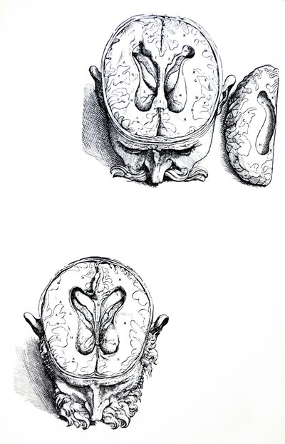 De Platen uit het Zevende Boek van de De Humani Corporis Fabrica door Andreas Vesalius
