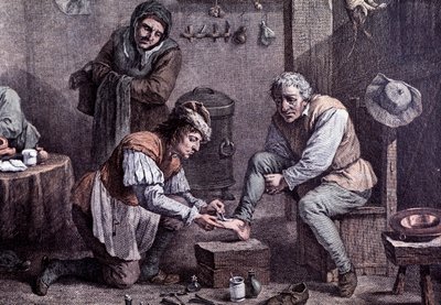 Een chirurgische operatie (gravure) door Anonymous Anonymous