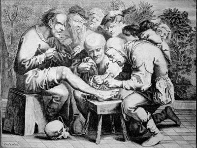 Enkeloperatie (gravure) door Anonymous Anonymous