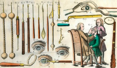 Chirurgie in de 18e eeuw: oogoperatie. Instrumenten voor staaroperatie en kunstmatige pupilvorming. Gravure in 