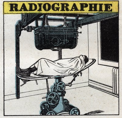Röntgenstralen: Röntgenapparaat. Anonieme illustratie uit 1925. Privécollectie. door Anonymous Anonymous