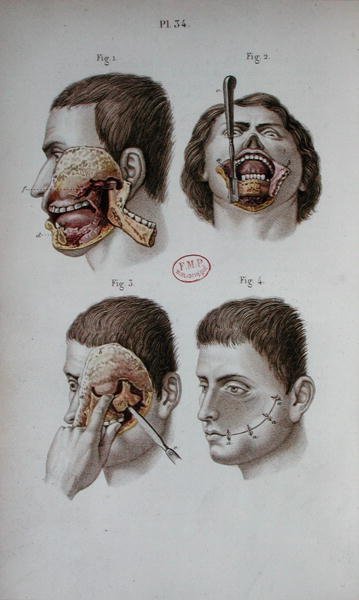 Anatomische plaat van de bovenkaak door C and Huette E. Bernard