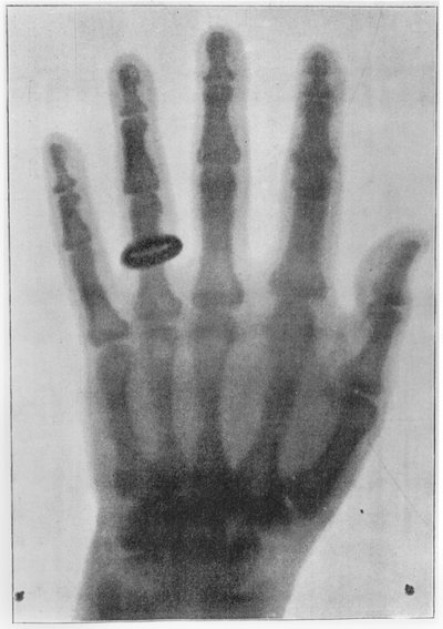 Röntgenfoto van de linkerhand van Anna Bertha Ludwig, de vrouw van Röntgen door Carl August Voller