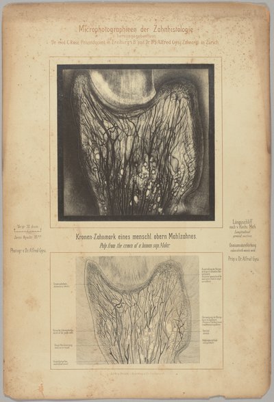 Pulp van de kroon van een menselijke sup. molaar door Dr. Alfred Gysi