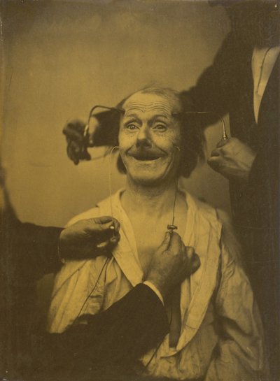 Een valse, onvolledige uitdrukking van aangename verrassing of bewondering, 1854-1856, gedrukt 1862 door Duchenne de Boulogne
