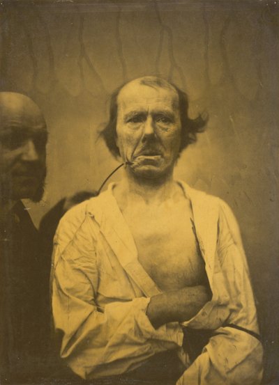 Een ontspannen uitdrukking links, Walging rechts, 1854-1856, gedrukt 1862 door Duchenne de Boulogne