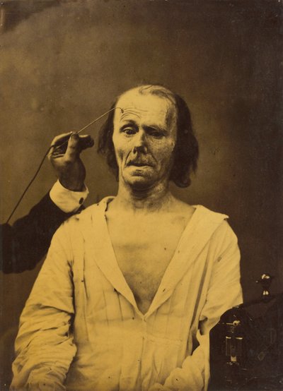 Een ontspannen gezicht links, Diepe aandacht rechts, 1854-1856, gedrukt 1862 door Duchenne de Boulogne