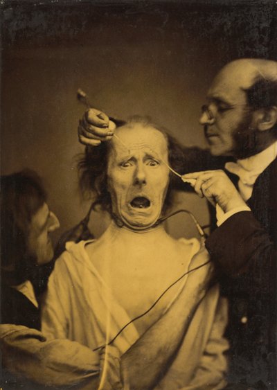 Angst vermengd met pijn, marteling, 1854-1856, gedrukt 1862 door Duchenne de Boulogne