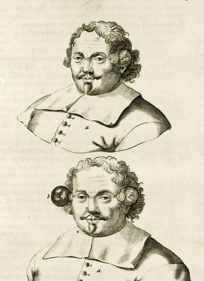 Een voorbeeld van koppen, uit Exercitationes Practicae circa Medendi Methodum door Frederik Dekkers, 1694 door Dutch School