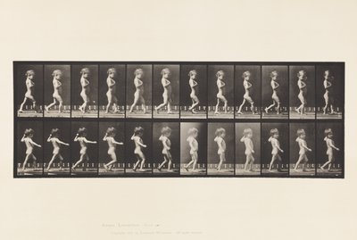 A, O-benen; Jongen; B, Spinale Caries; Meisje Lopend door Eadweard Muybridge