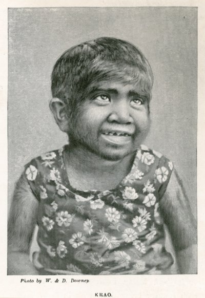 Krao, De Missing Link, tentoongesteld in het Aquarium, Westminster, Londen, in 1887 door English Photographer