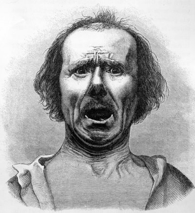 Horror en Agonie, gekopieerd van een foto door Dr. Duchenne, illustratie uit 