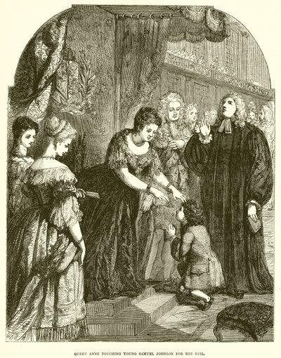 Koningin Anne raakt de jonge Samuel Johnson aan voor de kwaal door English School