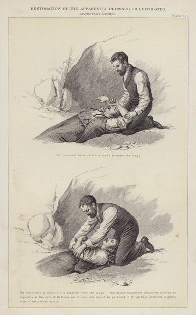 Herstel van de schijnbaar verdronken of verstikte (gravure) door English School