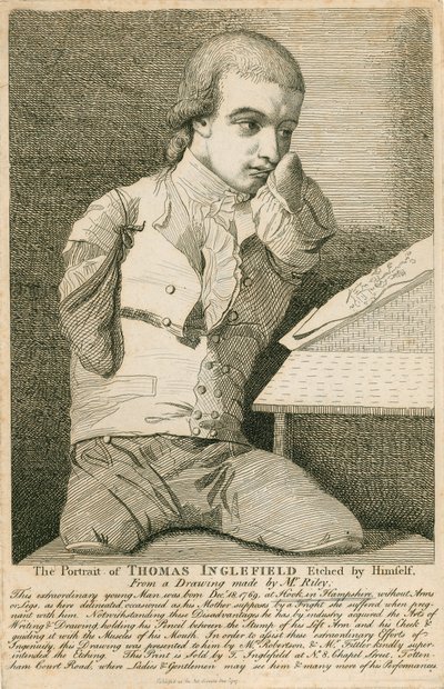 Thomas Inglefield, geboren 18 december 1769 in Hook, Hampshire, zonder armen of benen door English School