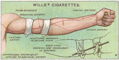 Tourniquet, nr.11 uit de Eerste Hulp-serie van Willss Cigarettes kaarten door English School