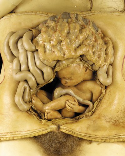 Anatomisch model van een ovariumzwangerschap (detail) (was) door European School