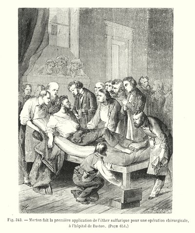 Morton doet de eerste toepassing van zwavelige ether voor een chirurgische operatie, in het ziekenhuis van Boston door European School