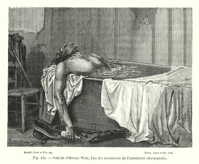 Zelfmoord van Horace Wels, een van de uitvinders van chirurgische anesthesie door European School