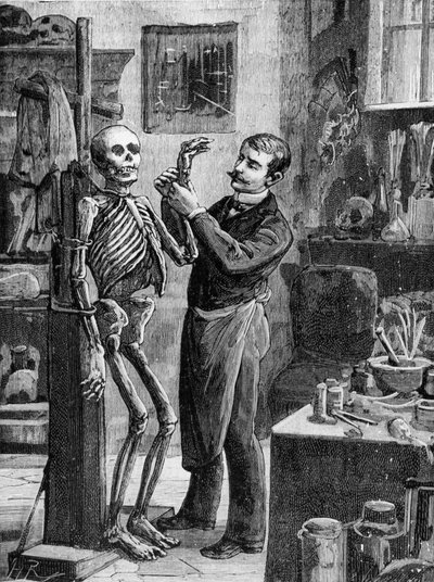 Zaak Gouffé: De imaginaire reconstructie van het lijk Gouffé door dr. Lacassagne - in 