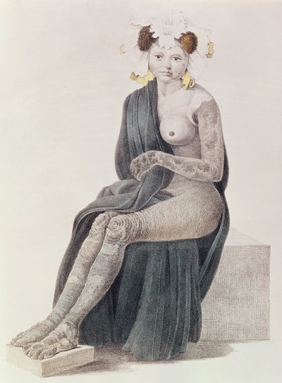 Aangeboren ichthyosis, uit een boek door G.M. Olbers, 1830 door French School