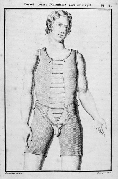Korset om onanie te voorkomen, illustratie uit Traite des bandages et appareils door J.B.J. Thillaye, Parijs, gepubliceerd 1815 door French School