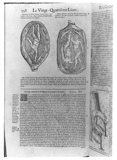 Foetus, illustratie uit Oeuvres door Ambroise Pare (1509-90) gepubliceerd in Lyon, 1641 door French School