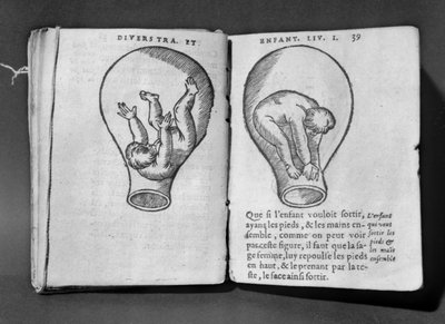 Foetus in de baarmoeder, illustratie uit het zogenaamde Rhodion-manuscript door French School
