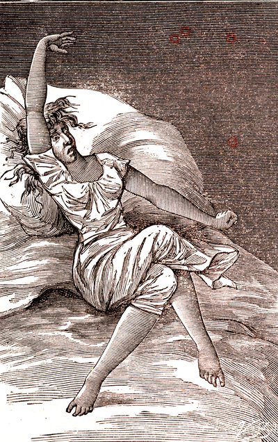 Hoofdpijn, melancholie en hysterie, angst. 1887 (gravure) door French School