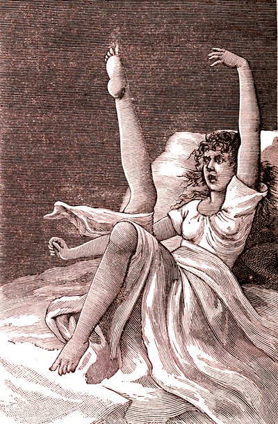 Hysterie, een extreem mentaal fenomeen, psychosen en psychoneurosen.1887 door French School