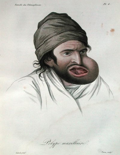 Maxillaire poliep, uit een boek door Baron Jean Louis Alibert 1817 (gekleurde gravure) door French School