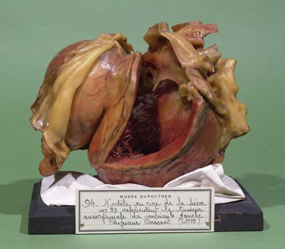 Model van een tumor van de linker hartkamer, 1799 (was) door French School