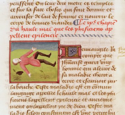 Patiënt die lijdt aan een epileptische aanval, uit Le Livre des Proprietes des choses door Barthelemy l