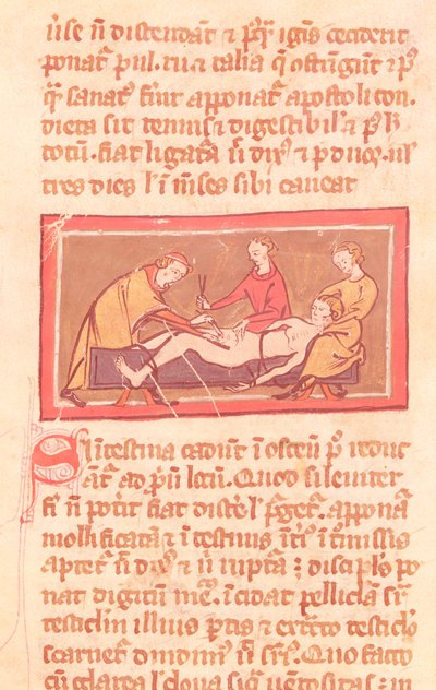 Chirurgie, uit een editie van het Boek van Chirurgie door Rogier de Salerne door French School