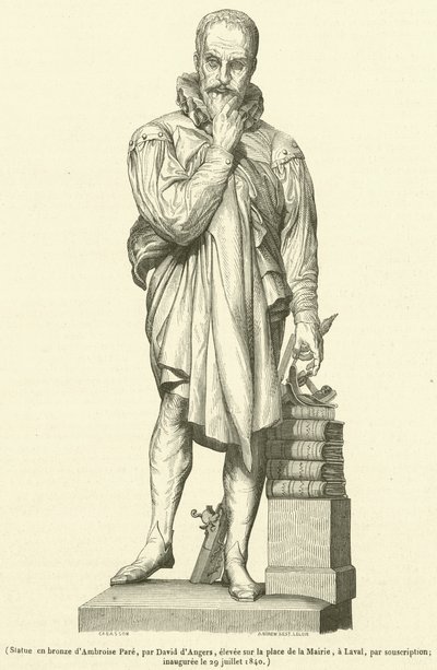 Bronzen standbeeld van Ambroise Pare door French School