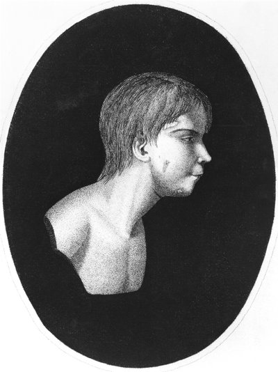 Victor van Aveyron, frontispice van De l