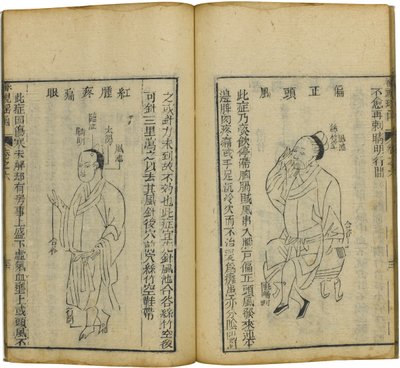 Shen Shi Yao Han Een Kostbaar Boek over Oogheelkunde, 1644 door Fu Renyu