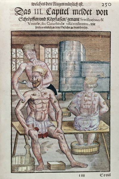 Cupping, uit Ophthalmodouleia door Georg Bartisch (1535-1636) gepubliceerd in Dresden in 1583 door German School