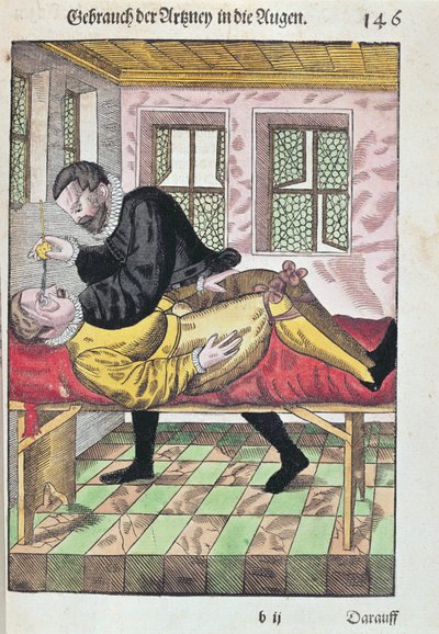 Oogoperatie, uit Ophthalmodouleia door Georg Bartisch gepubliceerd in Dresden in 1583 door German School