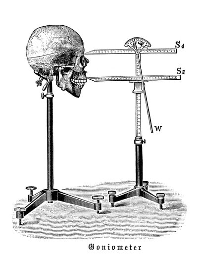 Goniometer meet menselijke schedel door German School