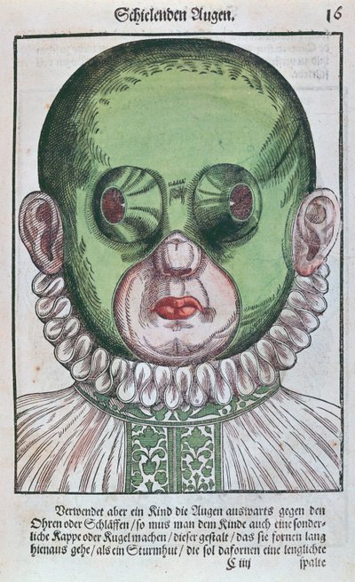 Masker voor de behandeling van strabismus, uit Ophthalmodouleia door Georg Bartisch, gepubliceerd in Dresden in 1583 door German School