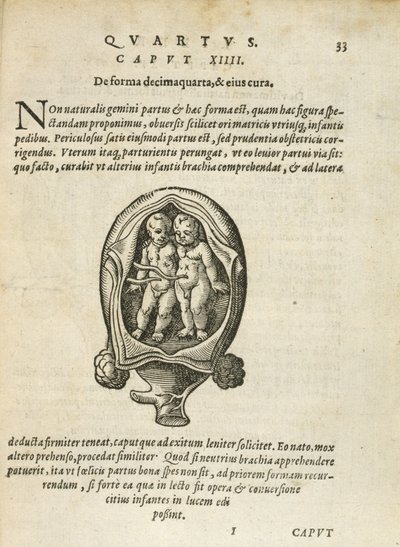 Niet-identieke tweelingen in de baarmoeder, illustratie uit hoofdstuk 14, Boek 4 van Over de conceptie en groei van de mens door Rueff, 1587 door German School