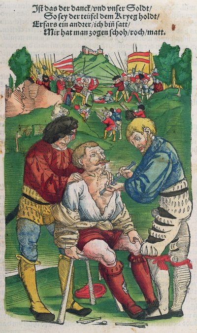 Een pijl verwijderen, illustratie uit Feldtbuch der Wundartzney door Hans von Gersdorff, 1540 door German School