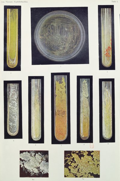 Syfilis Bacillus, uit een boek door Max von Niessen, Leipzig, 1908 door German School