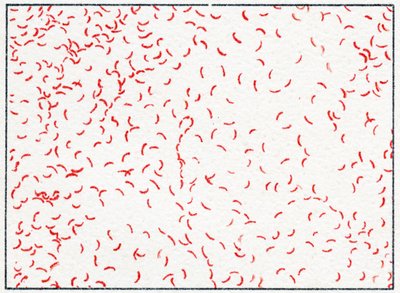 Bacterie Vibrio cholerae door German School