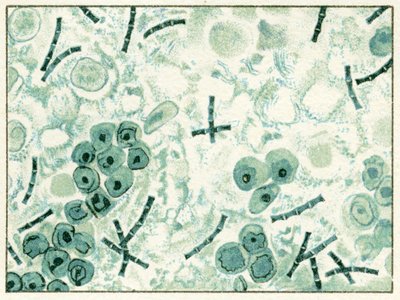 Monster van miltvuurbacteriën in bloed door German School