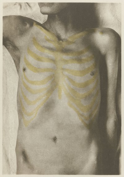 Anatomische foto van een mannelijk lijk: 