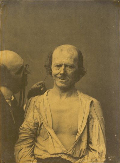 Een Ontspannen Gezicht (links); Valse Vreugde of Lachen (rechts) door Guillaume Benjamin Amant Duchenne