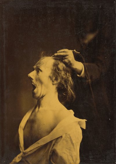 Verbazing, Verbijstering, Verwondering door Guillaume Benjamin Amant Duchenne