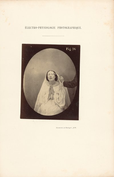 Fotografische elektrofysiologie, Afbeelding 76 door Guillaume Benjamin Duchenne